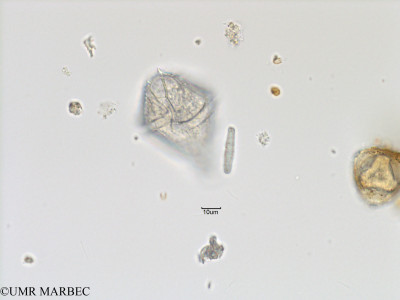 phyto/Bizerte/bizerte_bay/RISCO November 2015/Gonyaulax kofoidii (Baie_T5-C1-Gonyaulax polygramma-2).tif(copy)_thumb.jpg